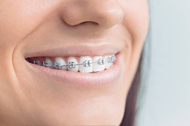 Best Teeth Whitening  in Canton, NC